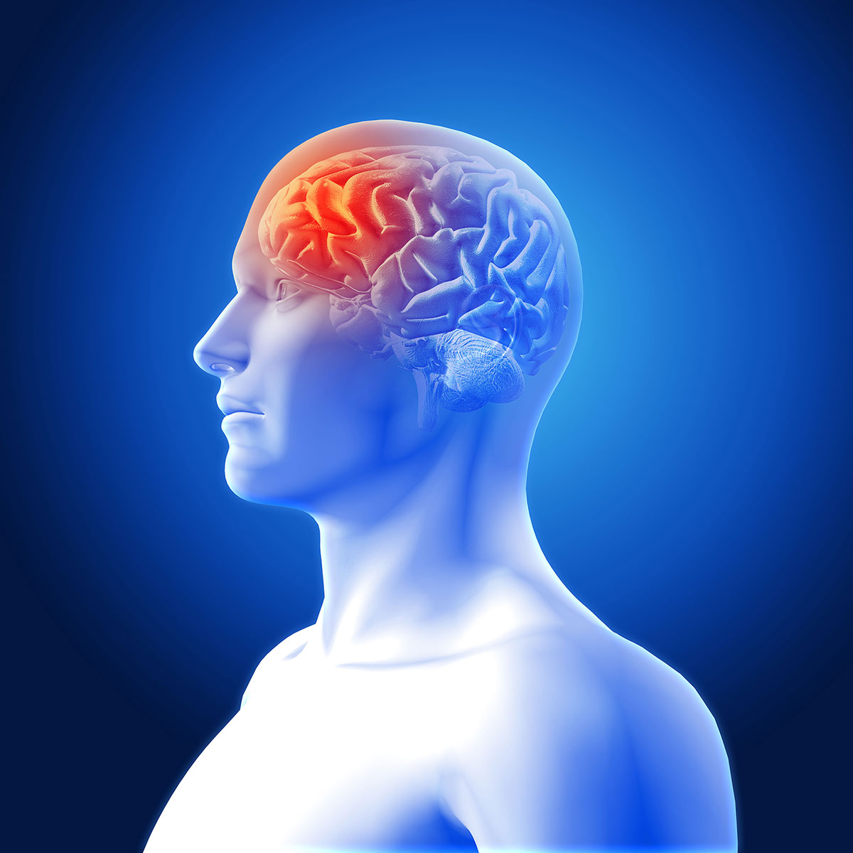 stroke disease symptom headache